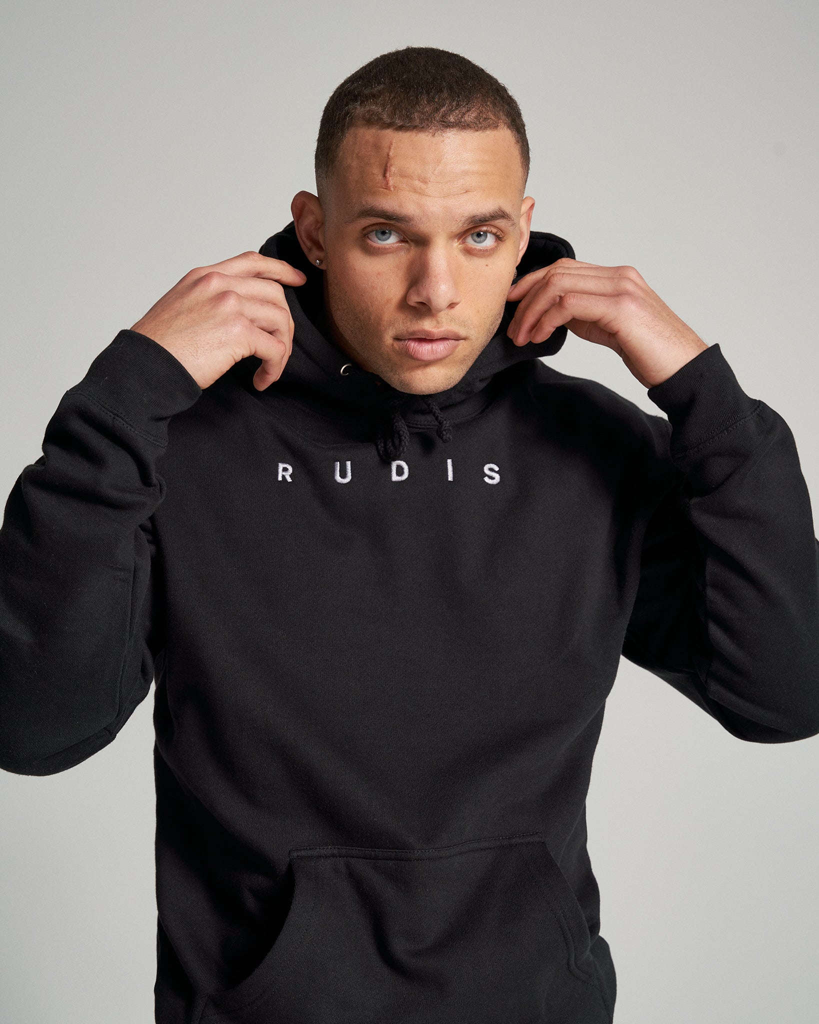 A young man wearing a black hoodie with the word RUDIS printed on it showcasing a confident expression and a subtle scar on his forehead